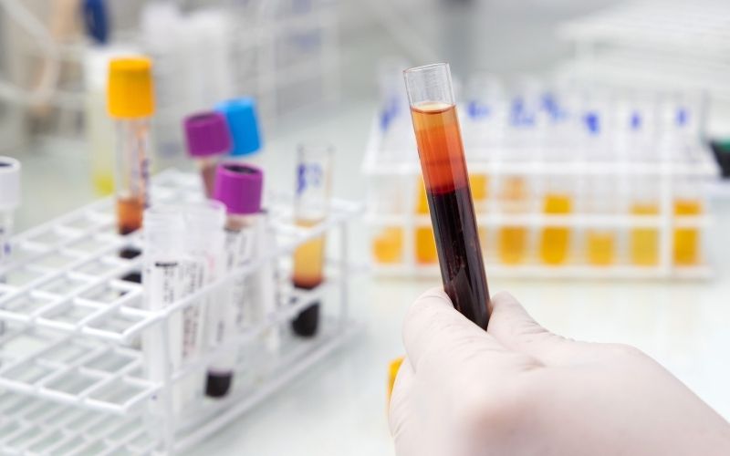 Double test có thể phát hiện hội chứng Down sớm. (Ảnh: Sưu tầm Internet)