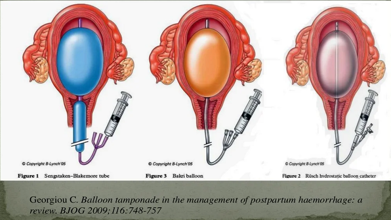 Khi máu vẫn tiếp tục chảy sẽ phải phải tiến hành can thiệp ngoại khoa (Ảnh: Sưu tầm Internet)