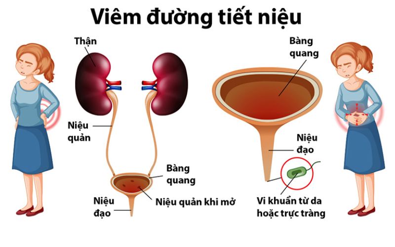 Các bộ phận của đường tiết niệu nữ. (Ảnh: Sưu tầm internet)