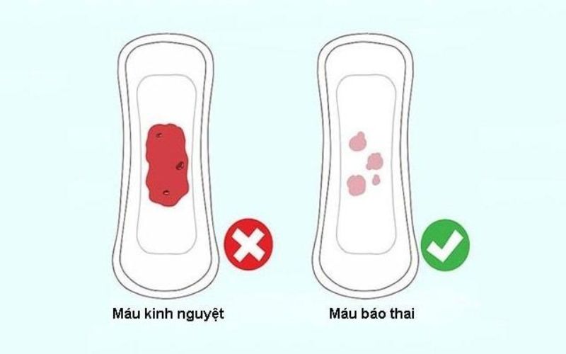 Phân biệt máu kinh nguyệt và máu báo thai. (Ảnh: Sưu tầm internet)