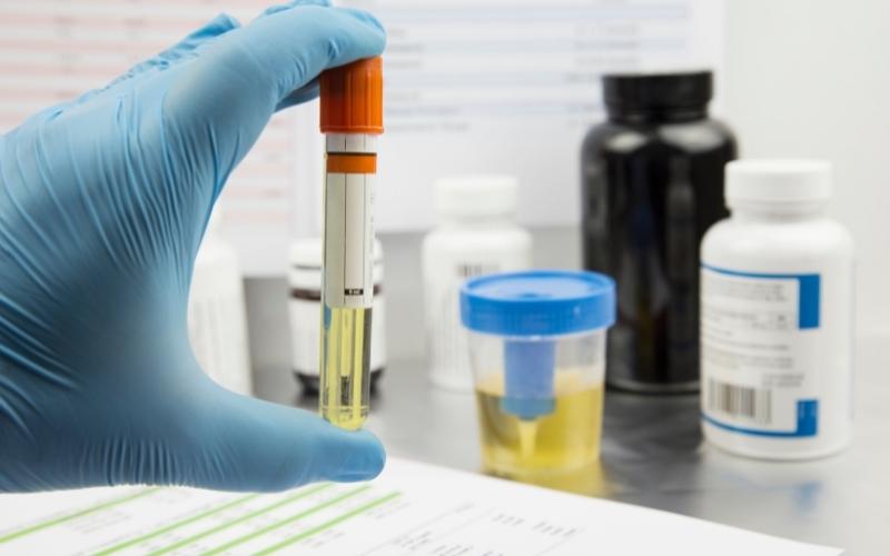 Xét nghiệm nước tiểu khi mang thai giúp phát hiện một số bệnh tiềm ẩn. (Ảnh: Sưu tầm Internet)