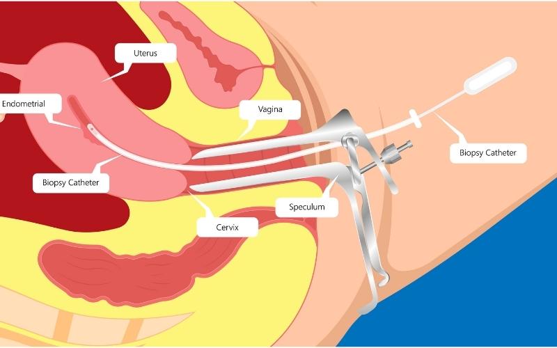 Điều trị nội khoa. (Ảnh: Sưu tầm Internet)