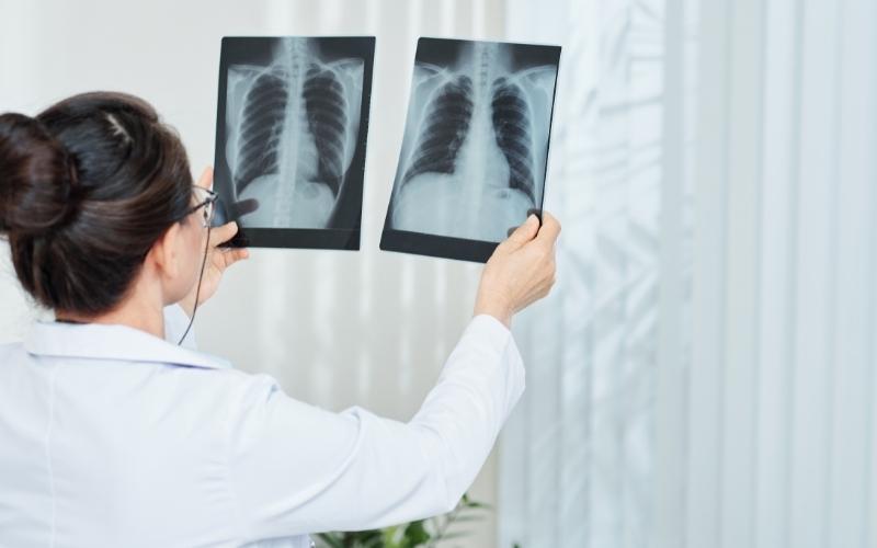 Lưu ý khi chụp X-quang để giảm thiểu rủi ro. (Ảnh: Sưu tầm Internet)