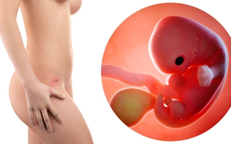 Hút thai từ tuần thứ 6 đến tuần 12 của thai kỳ. (Ảnh: Sưu tầm Internet)