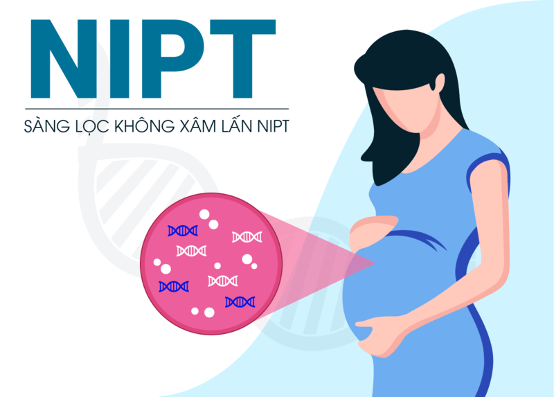 Phương pháp xét nghiệm nhiễm sắc NIPT. (Ảnh: Sưu tầm Internet)