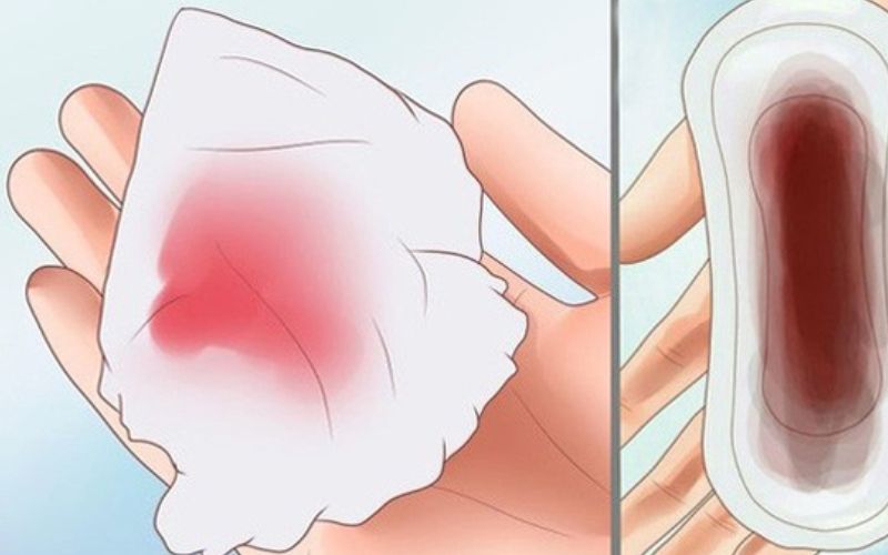 Chuyển phôi thất bại ra máu âm đạo. (Ảnh: Sưu tầm Internet)