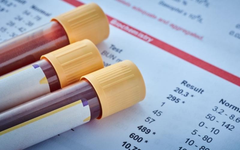 Xét nghiệm máu để nhận biết hàm lượng hormone hCG. (Ảnh: Sưu tầm Internet)