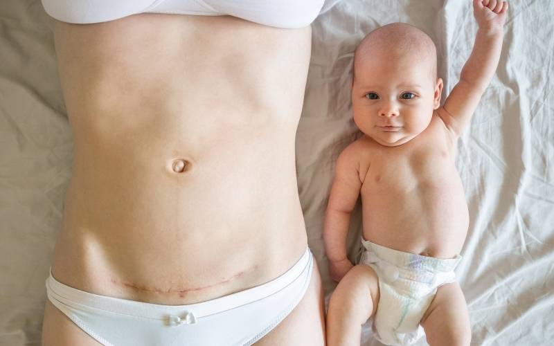 Mẹ từng sinh mổ cần cẩn thận khi quyết định mang thai lần 2. (Ảnh: Sưu tầm Internet)