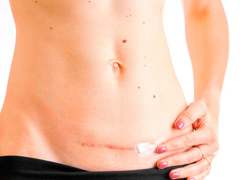 Uống collagen giúp vết thương mẹ sau sinh mau lành (Ảnh: Sưu tầm Internet)