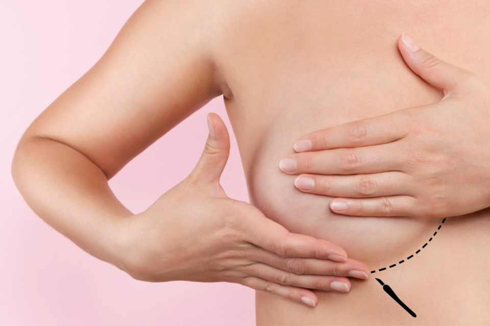 Massage ngực là phương pháp kích sữa hiệu quả của nhiều mẹ bỉm (Ảnh: Sưu tầm Internet)