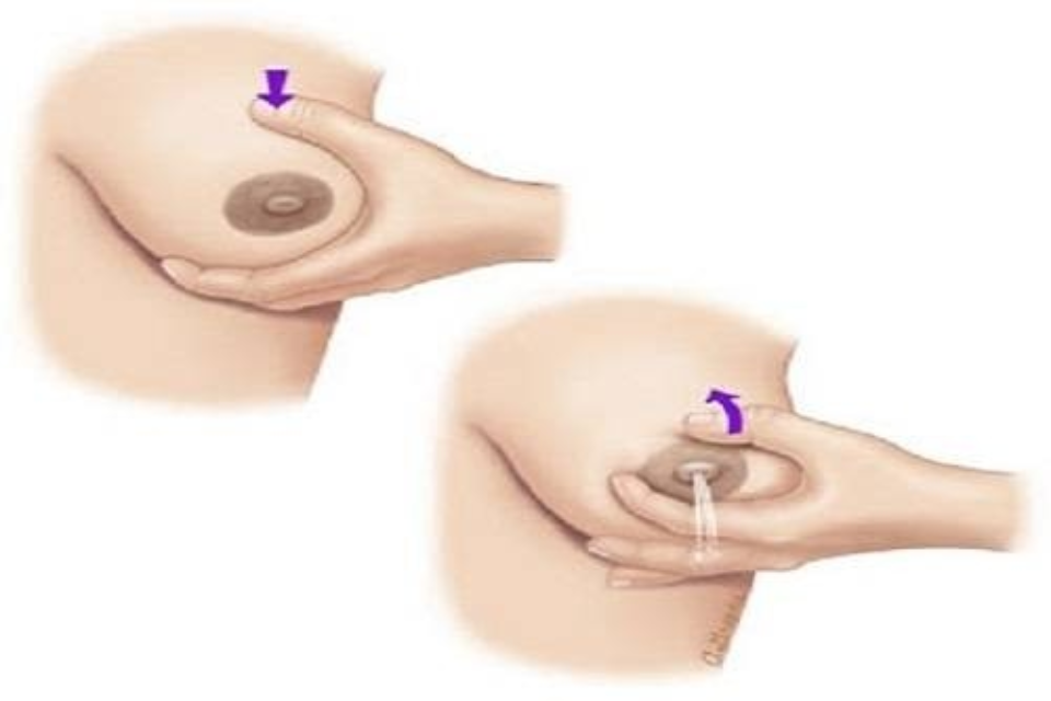 Vắt sữa bằng tay có thể giúp các mẹ làm tan các cục sữa tắc trong ống dẫn sữa (Ảnh: Sưu tầm Internet)