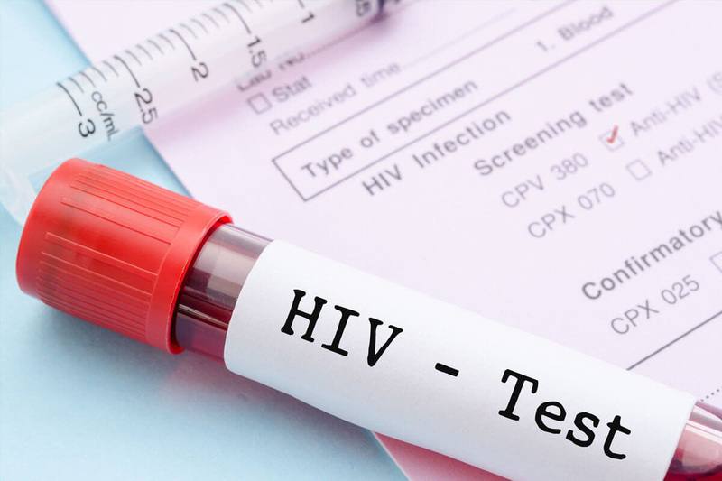 Xét nghiệm HIV trước tiền thai kỳ. (Ảnh: Sưu tầm Internet)
