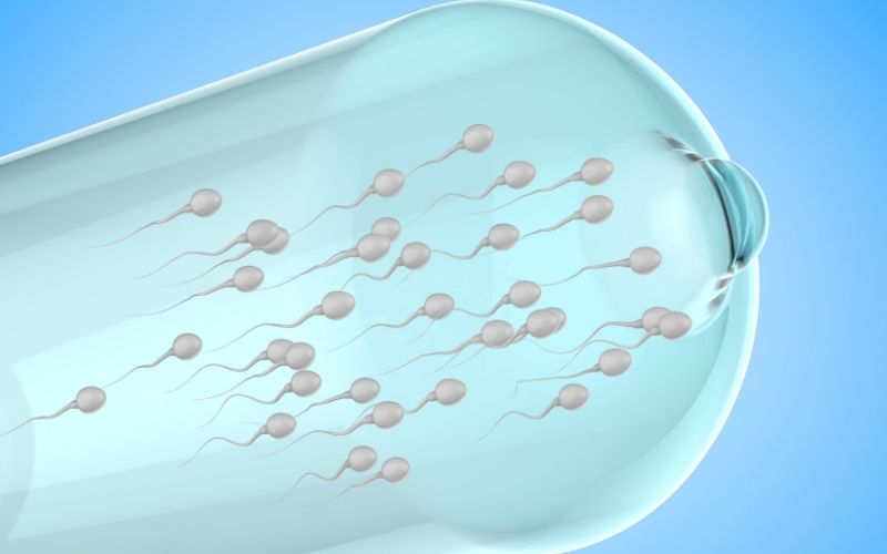 Lưu trữ tinh trùng ở nam giới. (Ảnh: Sưu tầm Internet)