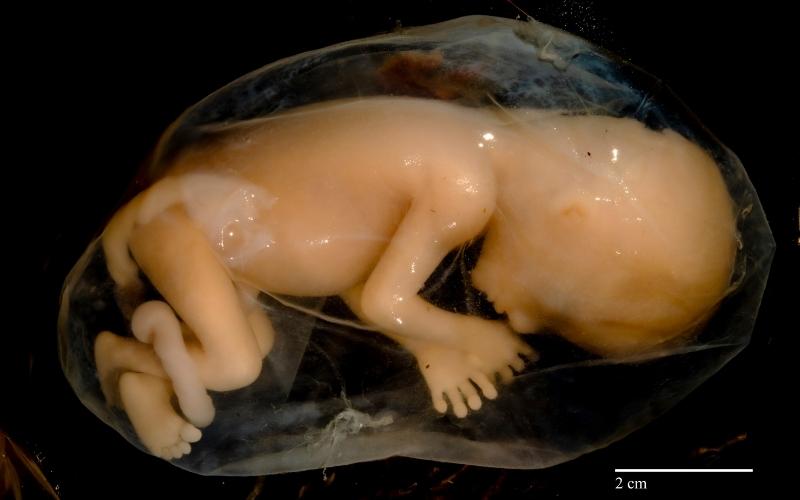 Cần đi bệnh viện ngay lập tức nếu thấy nước ối chảy ra. (Ảnh: Sưu tầm Internet)