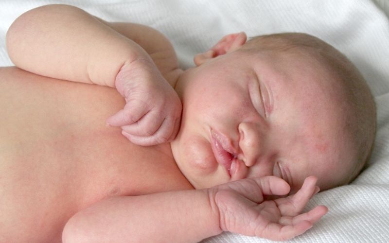 Một số dị tật có thể cải thiện sau sinh bằng phương pháp phẫu thuật. (Ảnh: Sưu tầm Internet)