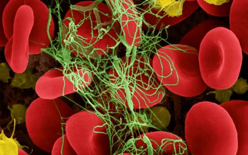 Nguy cơ bị máu đông do ăn quá nhiều dưa chuột. (Ảnh: Sưu tầm Internet)