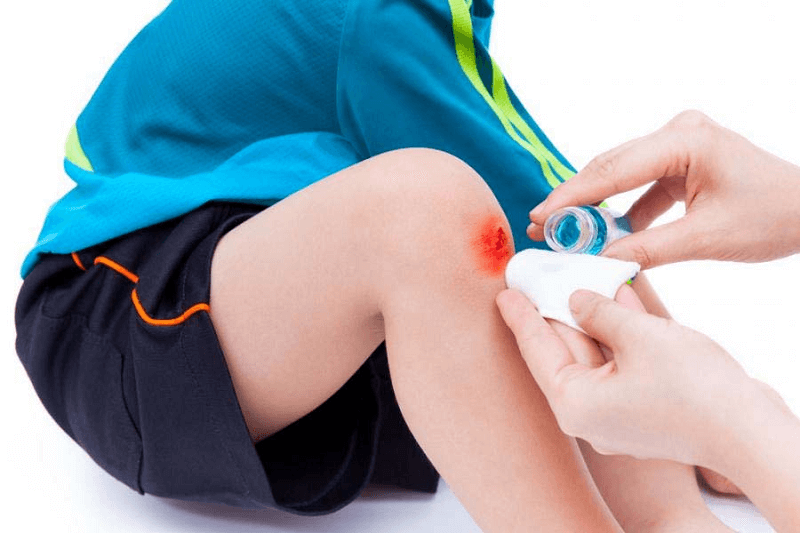 Kỹ năng sống ở nhà một mình: Kỹ năng sơ cứu khẩn cấp. (Ảnh: Sưu tầm Internet)