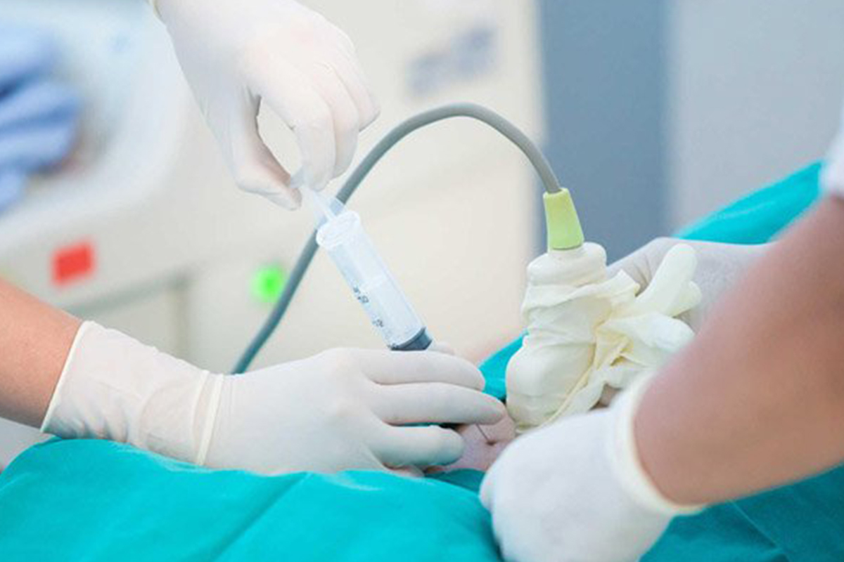 Phương pháp chọc ối. (Ảnh: Sưu tầm Internet)