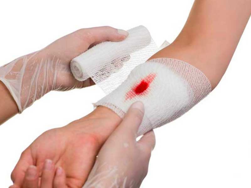 Dùng gạc vô trùng để băng bó vết thương cho trẻ (Ảnh: Sưu tầm internet)