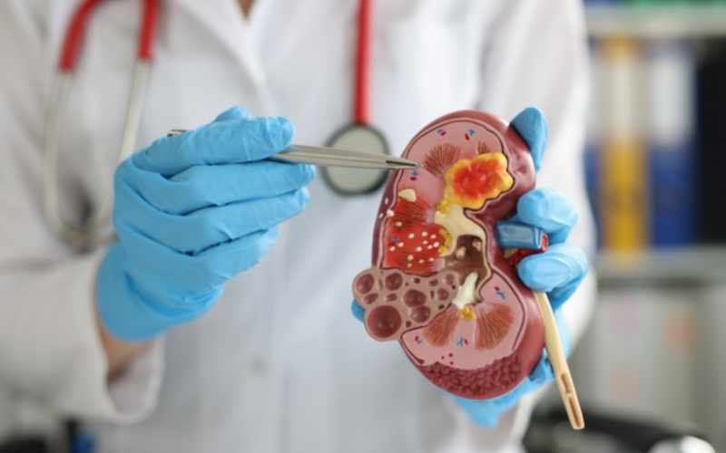 Một quả thận còn lại sẽ tăng cường công suất để hoạt động. (Ảnh: Sưu tầm Internet)