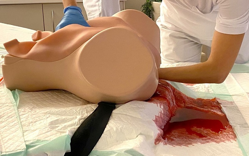 Khi cơ thể mất nhiều máu hơn 1500ml sản phụ sẽ có cảm giác ớn lạnh (Ảnh: Sưu tầm Internet)