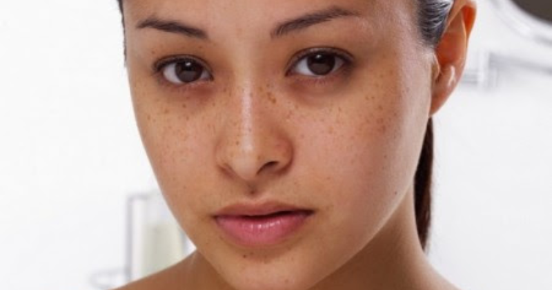 Hợp chất terpenoid giúp tăng khả năng chống lão hóa cho các mẹ bỉm sau sinh hiệu quả (Ảnh: Sưu tầm Internet)