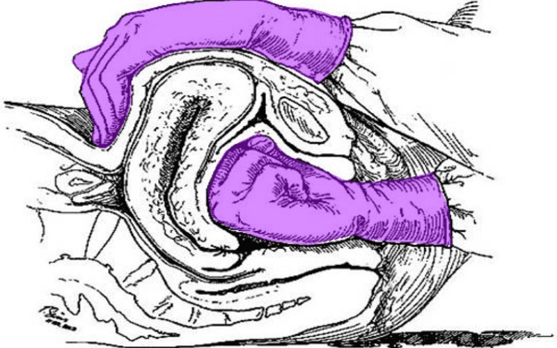 Sử dụng thuốc co hồi tử cung nếu mẹ bị băng huyết do đờ tử cung (Ảnh: Sưu tầm Internet)