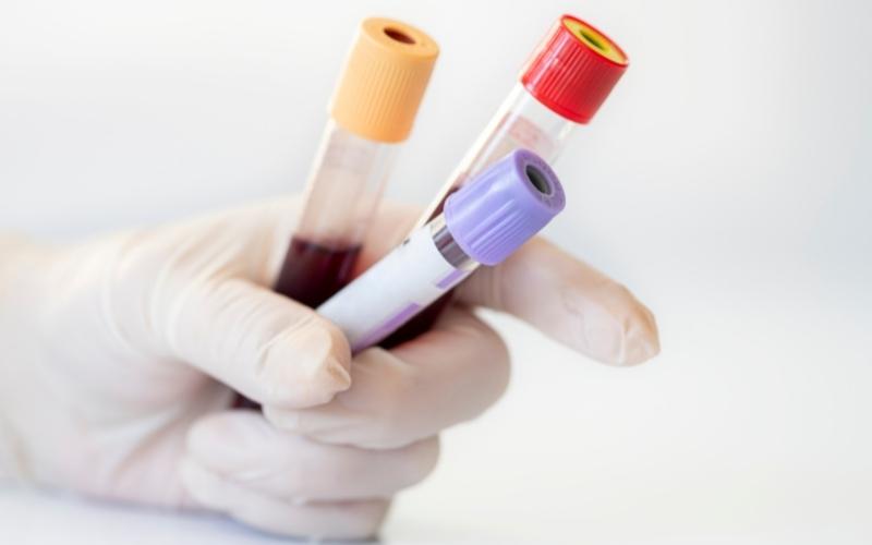 Xét nghiệm máu để chẩn đoán nồng độ hormone HCG. (Ảnh: Sưu tầm Internet)