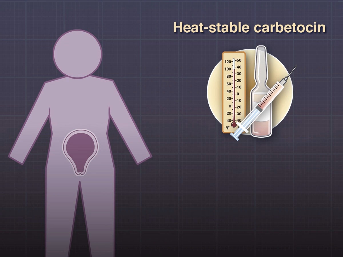 Dùng thuốc tăng co bóp và xoa bóp tử cung để kích thích tử cung co thắt (Ảnh: Sưu tầm Internet)