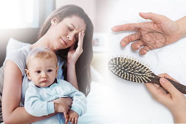 Mẹ sau sinh thường dễ bị rụng tóc do nhiều thay đổi trong cơ thể. (ảnh: Sưu tầm internet)