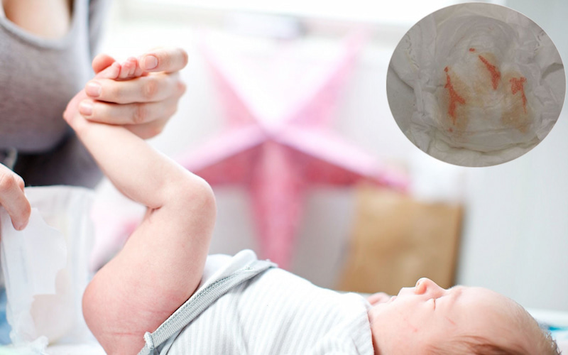 Nguyên nhân bé ăn dặm đi ngoài có mùi chua?. (Ảnh: Sưu tầm Internet)