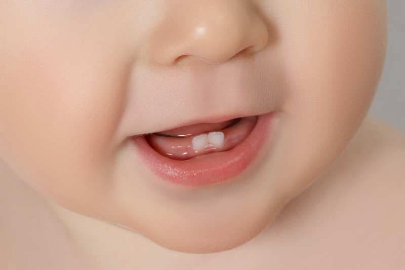 Khi nào nên đem bé khám bác sĩ khi sốt ho mọc răng. (Ảnh: sưu tầm internet)