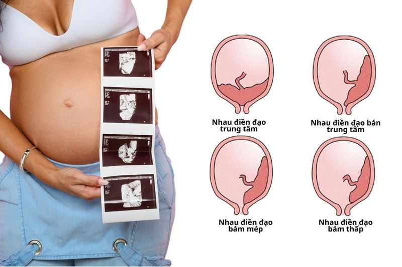 Tại sao một số mẹ bầu 3 tháng đầu không được quan hệ? (Ảnh: Internet)