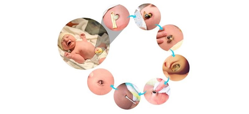 Chu trình cuống rốn của trẻ sơ sinh (Ảnh: Sưu tầm internet)