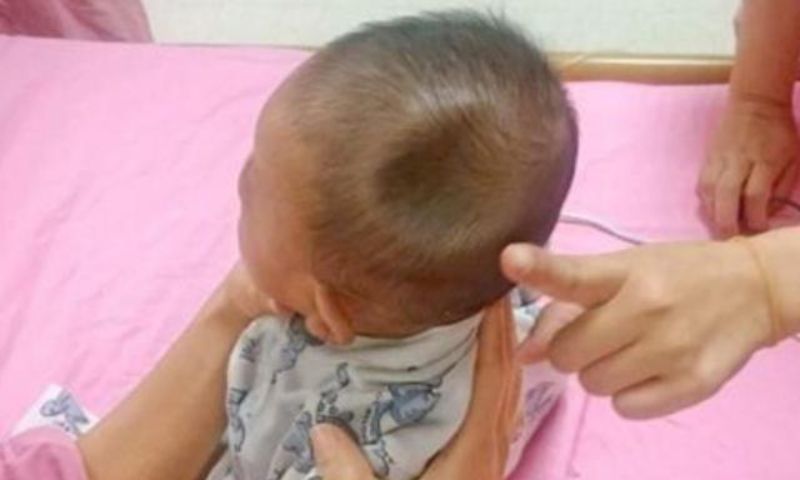 Vỡ sọ là tình trạng vô cùng nguy hiểm ảnh hưởng trực tiếp tới tính mạng của trẻ. (Ảnh: Nguồn