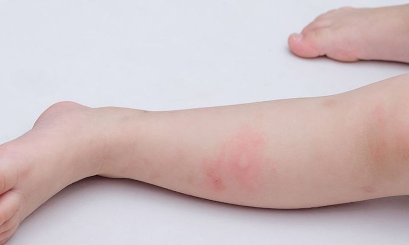 Cẩn trọng đối với các loài côn trùng có độc. (Ảnh: Nguồn Internet)