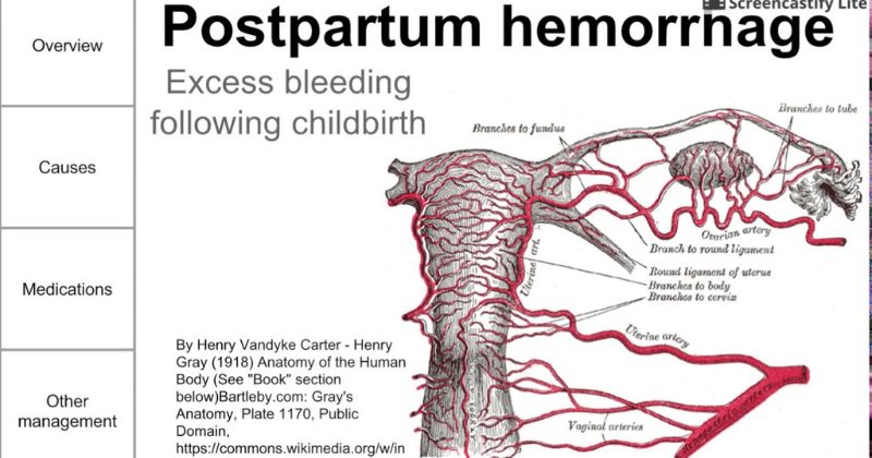Xử lý băng huyết do lộn tử cung (Ảnh: Sưu tầm Internet)