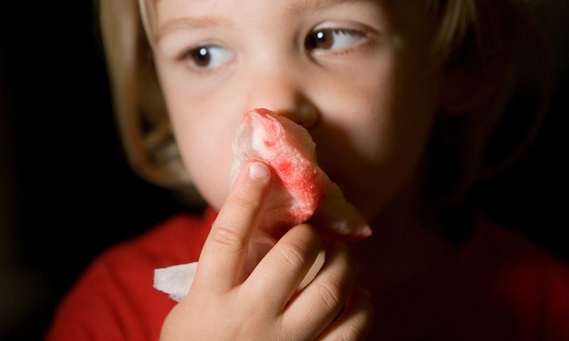 Trẻ bị ngã chảy máu mũi cần cực kì lưu ý. (Ảnh: Nguồn Internet)