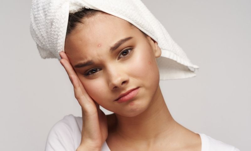 Sử dụng chè vằng ngâm giấm để giảm mụn. (Ảnh: Nguồn Internet)