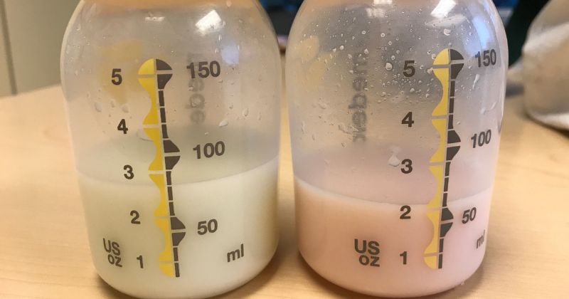 Hút sữa ra máu là tình trạng sữa có vẹt màu đỏ. (Ảnh: Sưu tầm Internet)