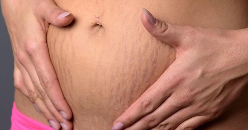 Tuân theo hướng dẫn khi dùng để đạt hiệu quả trị rạn tốt nhất (Ảnh: Sưu tầm Internet)