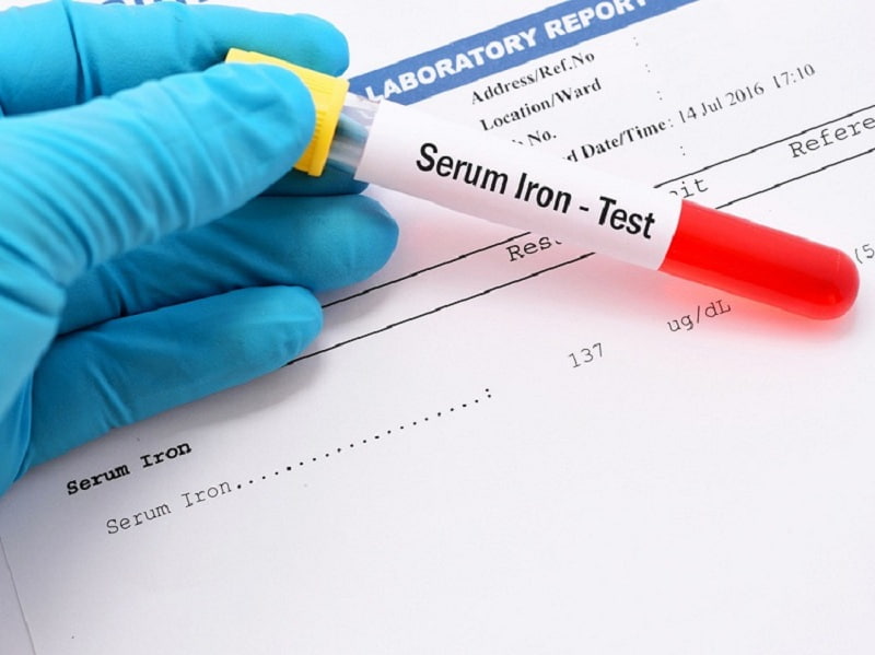 Xét nghiệm sắc huyết thanh. (Ảnh: Sưu tầm Internet)