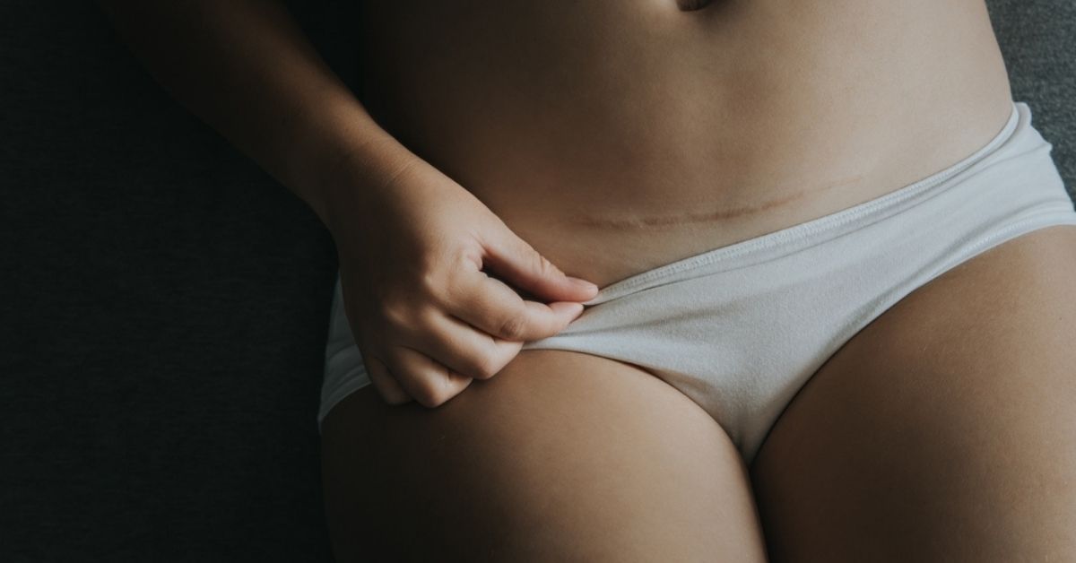 Một vài lưu ý mẹ không nên bỏ qua khi ở cữ sau sinh mổ lần 2 (Ảnh: Sưu tầm Internet)