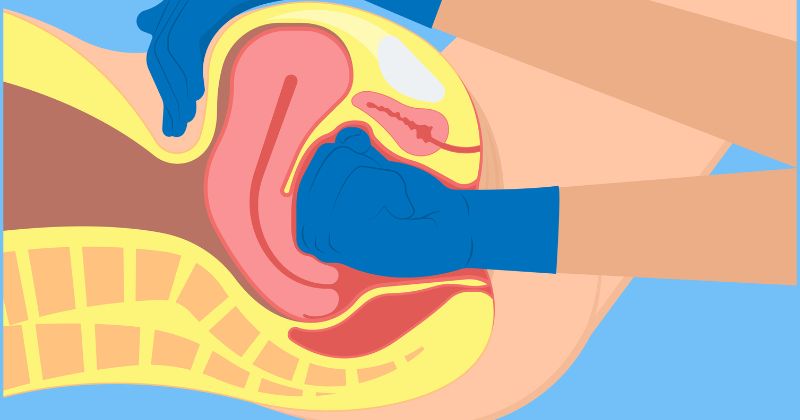 Cho trẻ bú sữa mẹ giúp ngừa băng huyết hậu sản (Ảnh: Sưu tầm Internet)