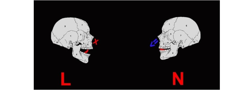 Lỗi phát âm ảnh hưởng rất nhiều đến việc giao tiếp, học tập. (Ảnh: Unica)