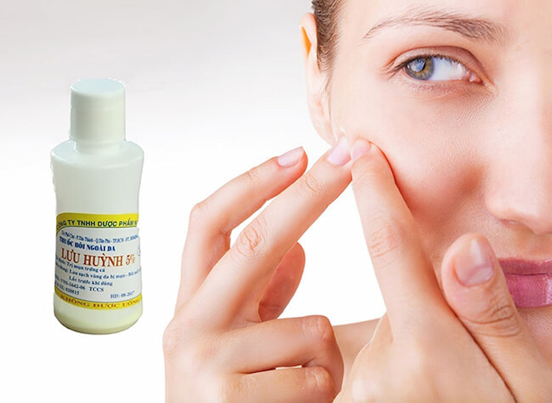 Ứng dụng của lưu huỳnh trong điều trị mụn trứng cá. (Ảnh: Sưu tầm Internet)