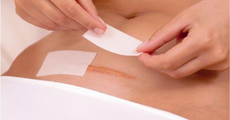 Trước khi rửa vết thương mổ tại nhà mẹ nên vệ sinh tay sạch sẽ (Ảnh: Sưu tầm Internet)