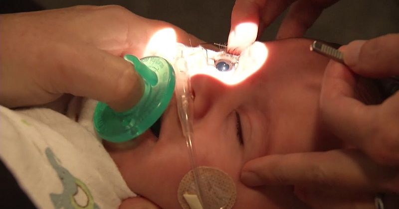 Khám bác sĩ là giải pháp an toàn nhất khi trẻ bị đau mắt. (Ảnh: Sưu tầm Internet)