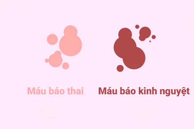 Nguyên nhân có bầu sau khi quan hệ bị ra máu. (Ảnh: Internet)