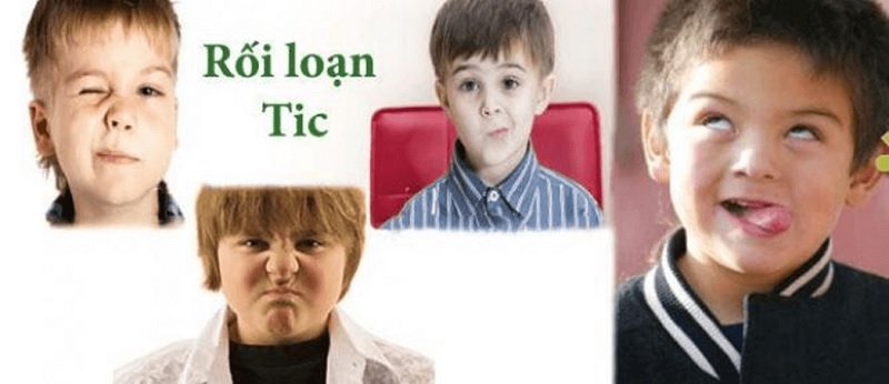 Rối loạn tic là hội chứng thường gặp ở trẻ nhỏ (Ảnh: Sưu tầm internet)